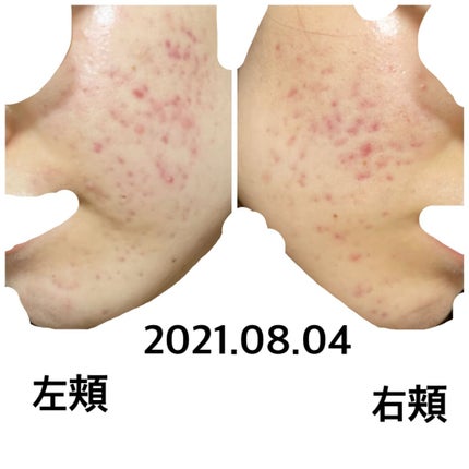 を使ったクチコミ(1枚目)