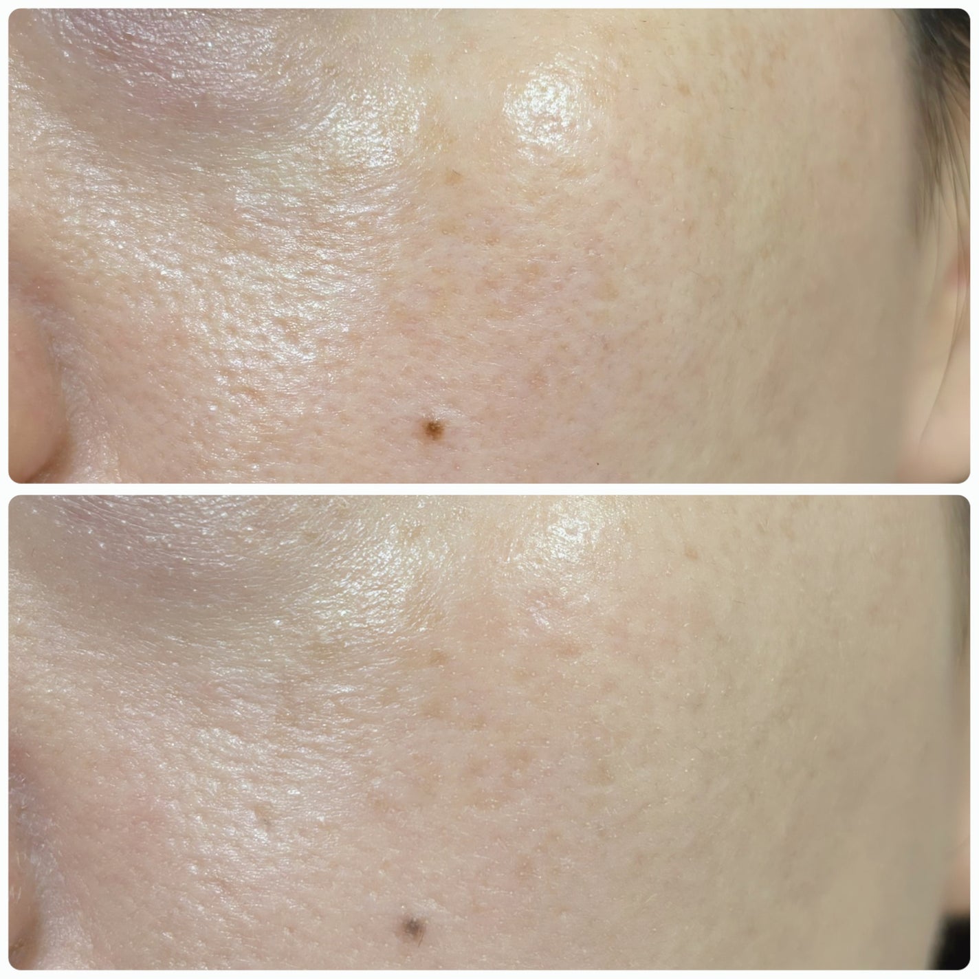 SIGNATURE ESSENCE COVER PACT /AGE20’s/クリーム・エマルジョンファンデーションを使ったクチコミ(4枚目)