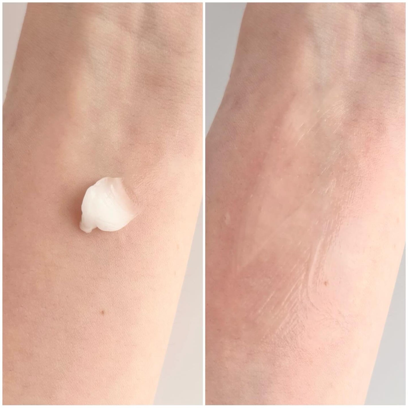 TX-Cream/Dr.Melaxin/フェイスクリームを使ったクチコミ(7枚目)