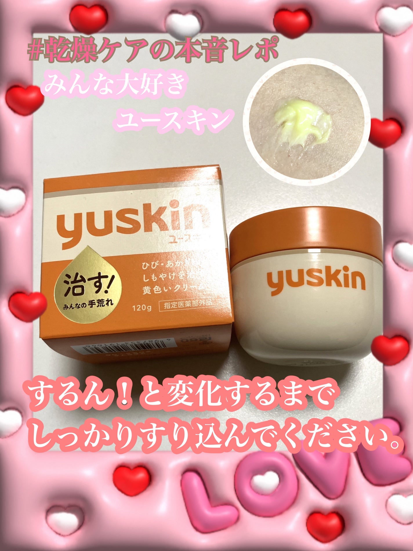 ユースキン/ユースキン/ボディクリームを使ったクチコミ(1枚目)