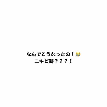 オードムーゲ オードムーゲ 薬用ローション（ふきとり化粧水）のクチコミ「助けて下さい(；＿；)

脂性肌というかオイリー肌でニキビが出来やすいです。

メイク落とし（.....」（1枚目）