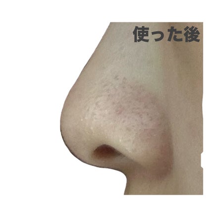 ノーズピーリングパック/One-day's you/シートマスク・パックを使ったクチコミ(5枚目)