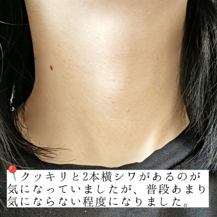 RSセラム/コスデバハ/美容液を使ったクチコミ(4枚目)