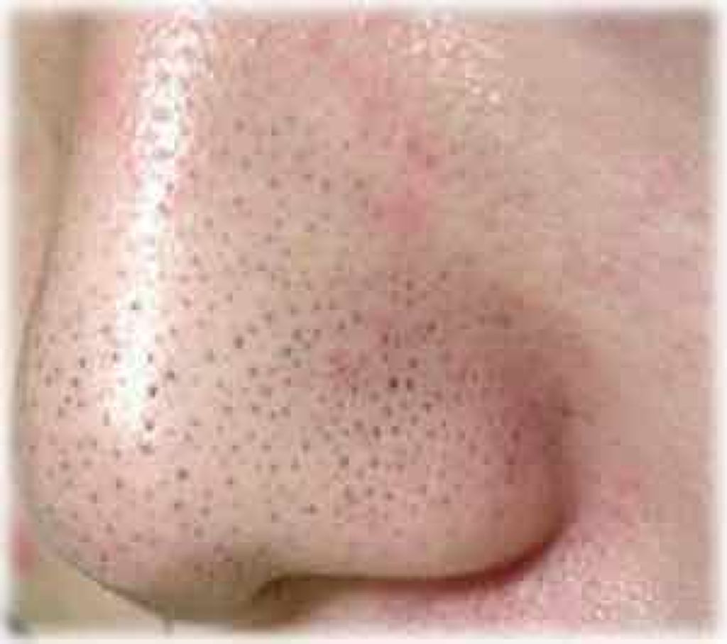 おうちdeエステ 肌をなめらかにする マッサージ洗顔ジェル/ビオレ/その他洗顔料を使ったクチコミ（3枚目）