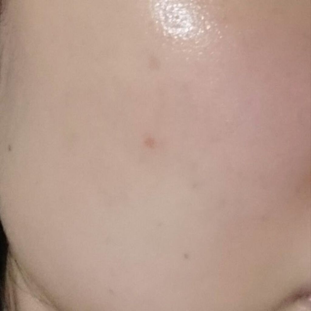 とろんと濃ジェル 薬用美白 N/なめらか本舗/オールインワン化粧品を使ったクチコミ（3枚目）