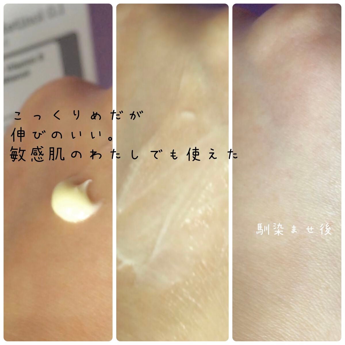 フルフィットプロポリスウルトラライトアンプル /COSRX/美容液を使ったクチコミ(5枚目)