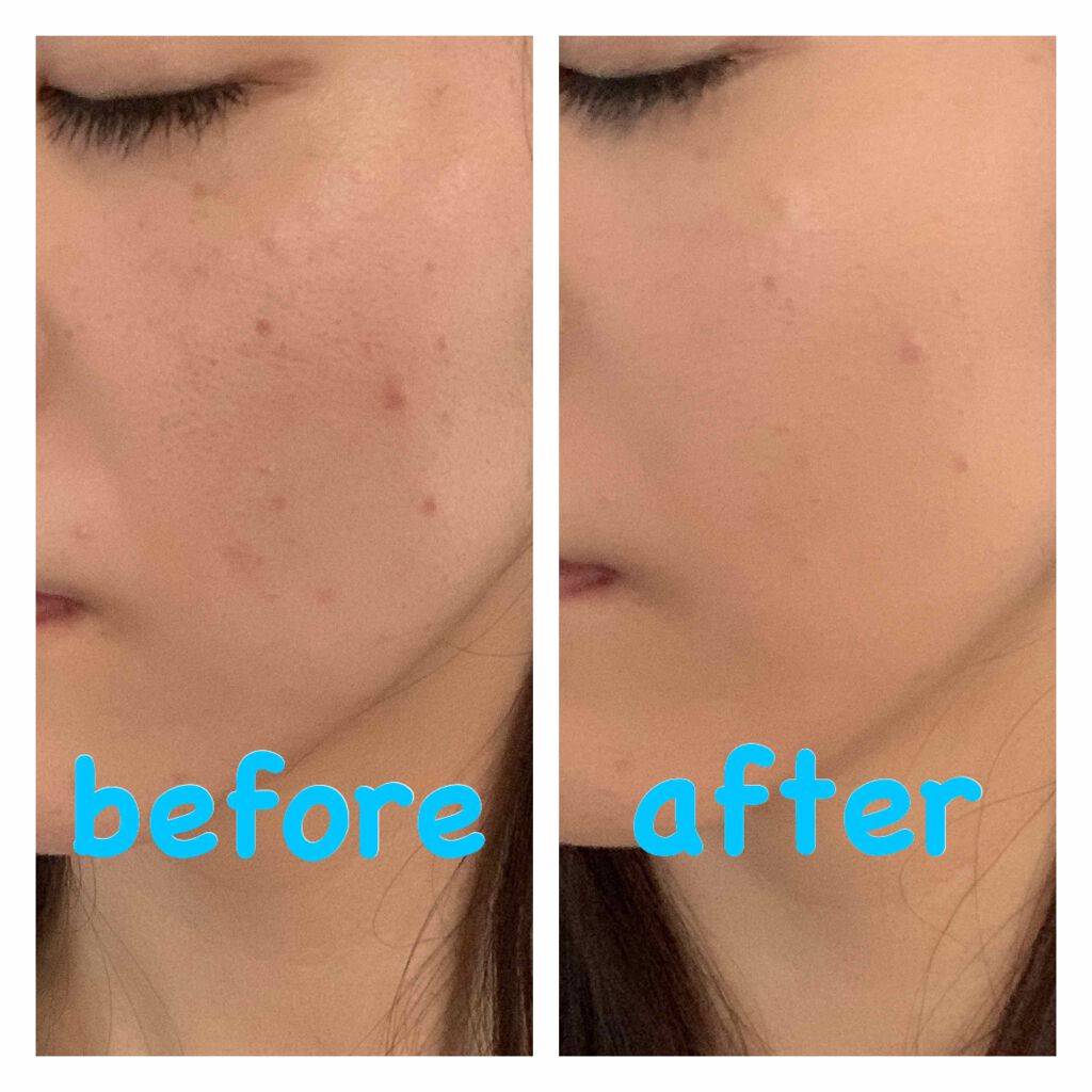 ビヨンド パーフェクティング ファンデーション 19/CLINIQUE/リキッドファンデーションを使ったクチコミ(1枚目)