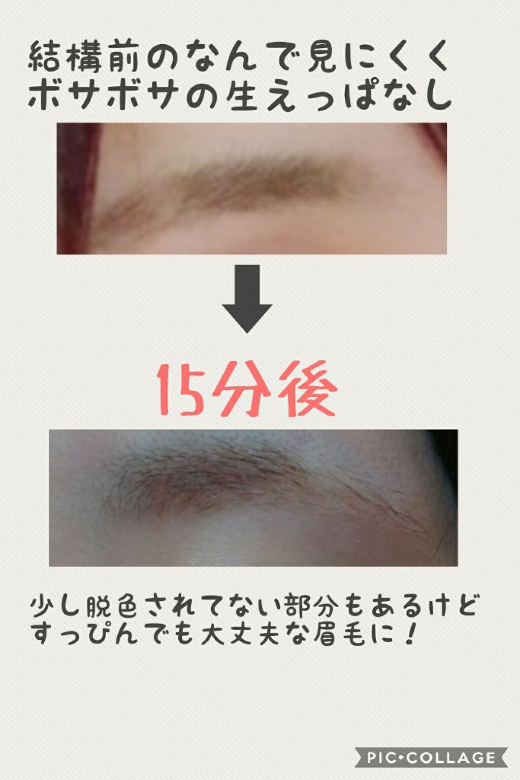 脱色クリーム 敏感肌用/エピラット/ムダ毛ケアを使ったクチコミ(2枚目)