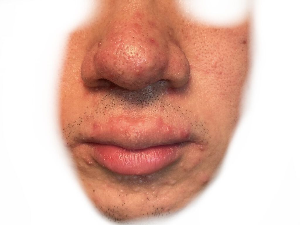 CICA デイリースージングマスク/VT/シートマスク・パックを使ったクチコミ（2枚目）