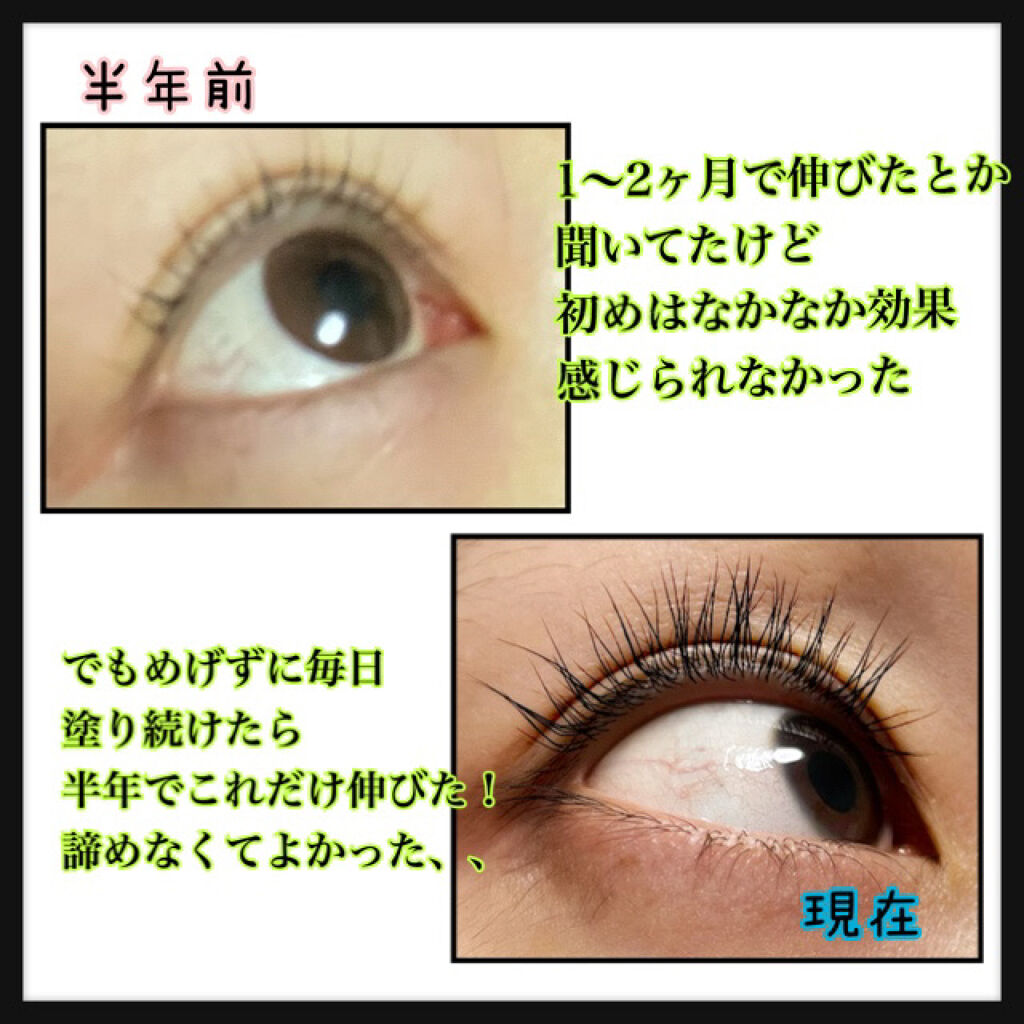 エグータム/アルマダスタイル/まつげ美容液を使ったクチコミ（2枚目）