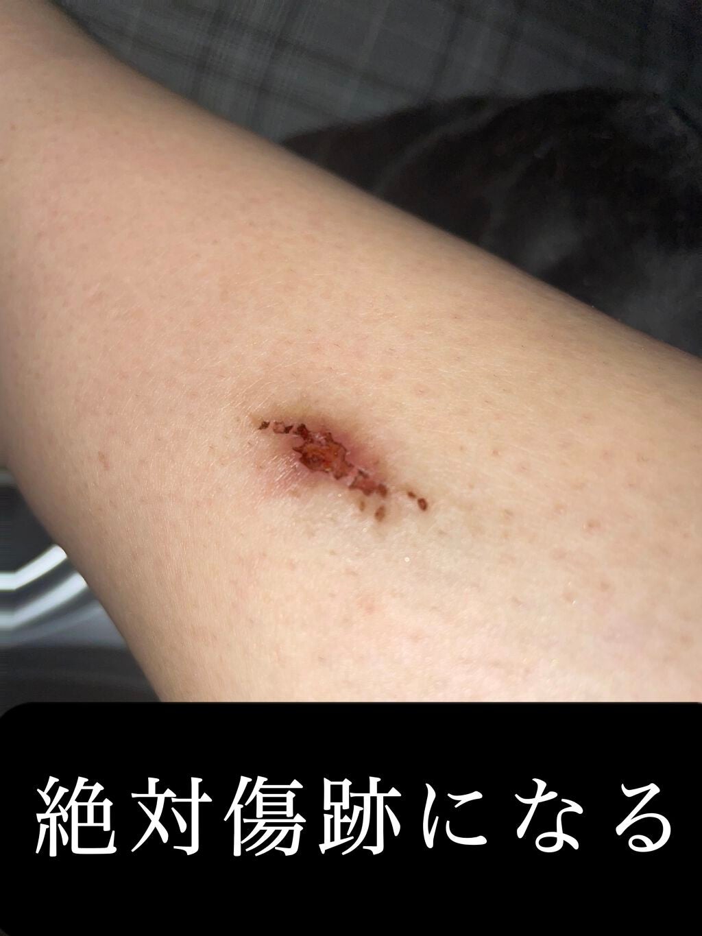 バスタイム除毛クリーム 敏感肌用/Veet/除毛クリームを使ったクチコミ(2枚目)