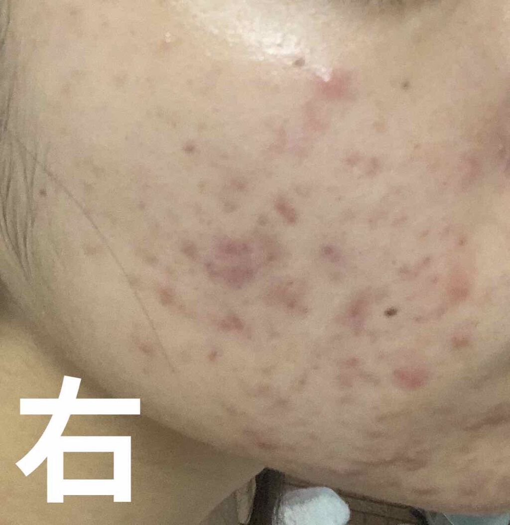 HiNaTa on LIPS ãð±ããããããèªåãåãå
¥ããŠæããð±ãããªã²ã«åããŠ2é±éã..ãïŒ1æç®ïŒ