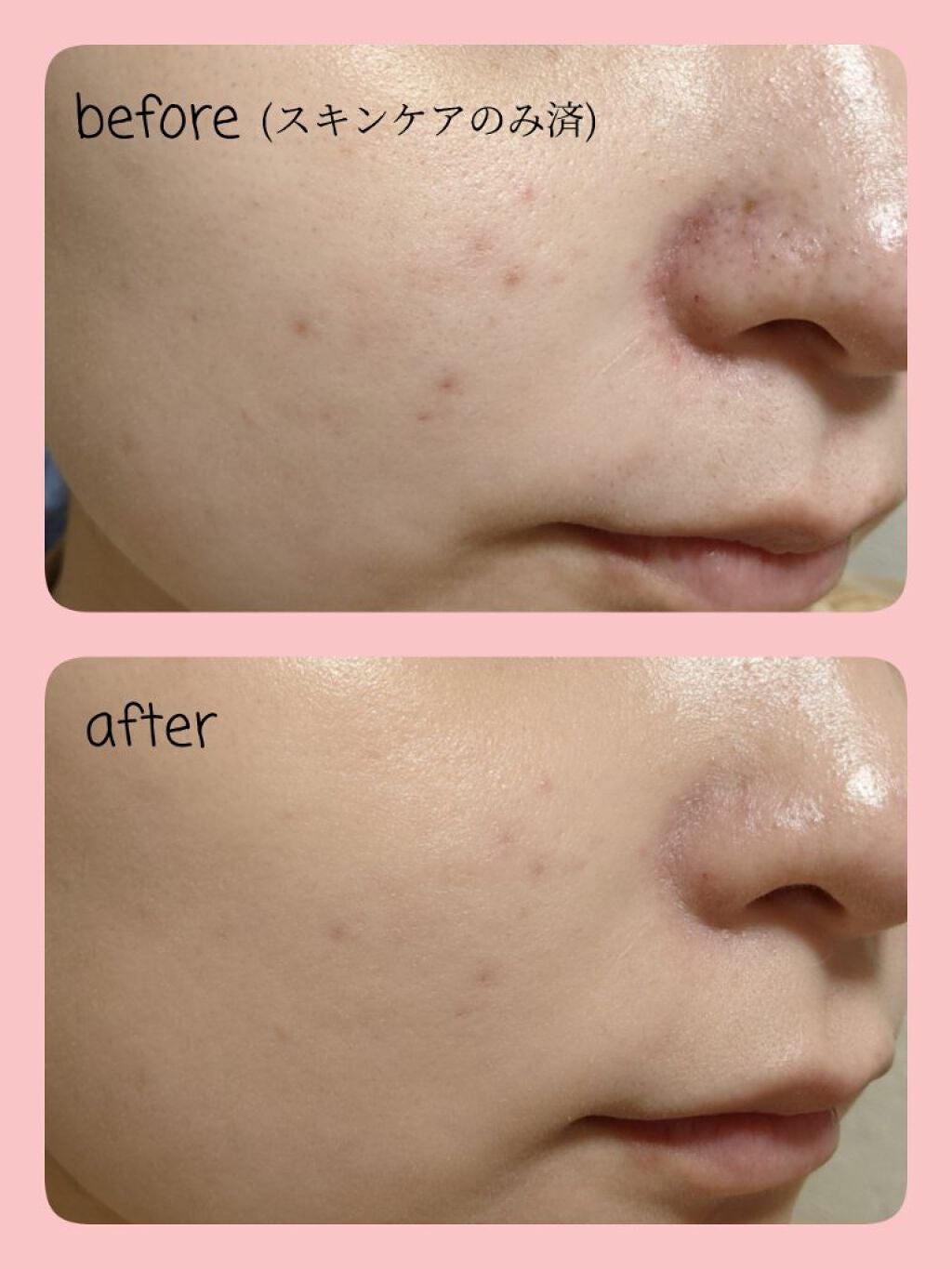 Luminous Natural Glow BB/TONYMOLY/BBクリームを使ったクチコミ(3枚目)