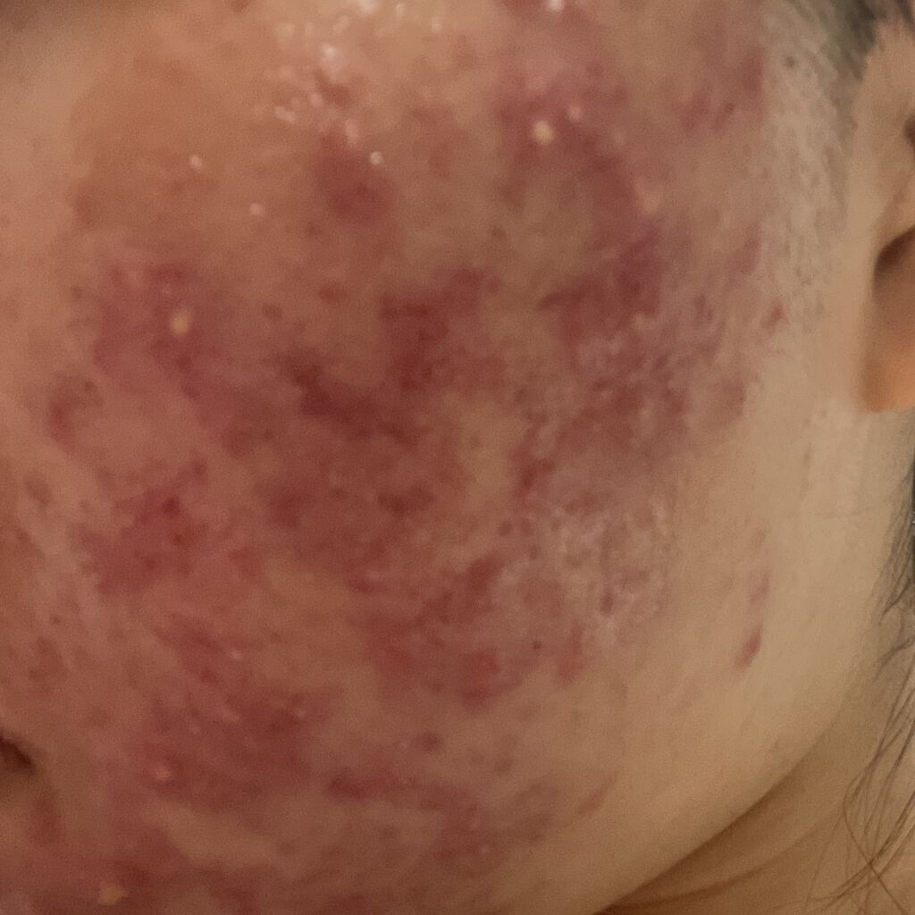 ゴールデンホホバオイル/SAKURA&NATURAL/ボディオイルを使ったクチコミ（3枚目）