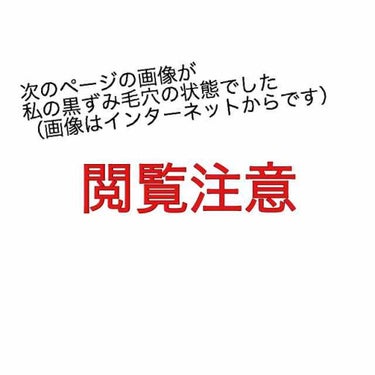 おうちdeエステ 肌をなめらかにする マッサージ洗顔ジェル/ビオレ/その他洗顔料を使ったクチコミ（2枚目）