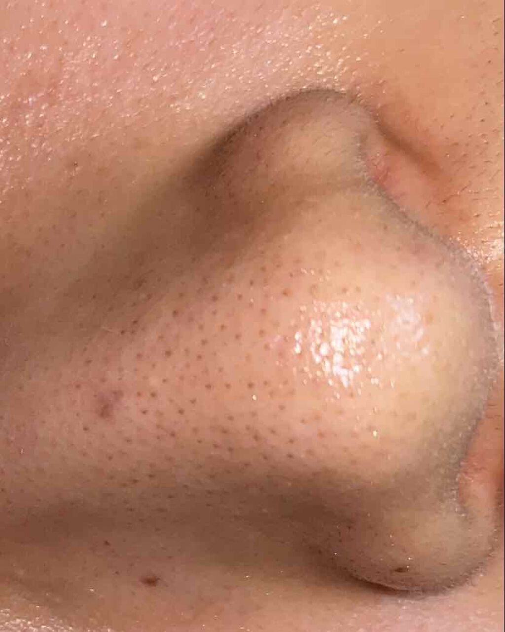 毛穴すっきりパック 鼻用 黒色タイプ/ビオレ/その他スキンケアを使ったクチコミ（1枚目）