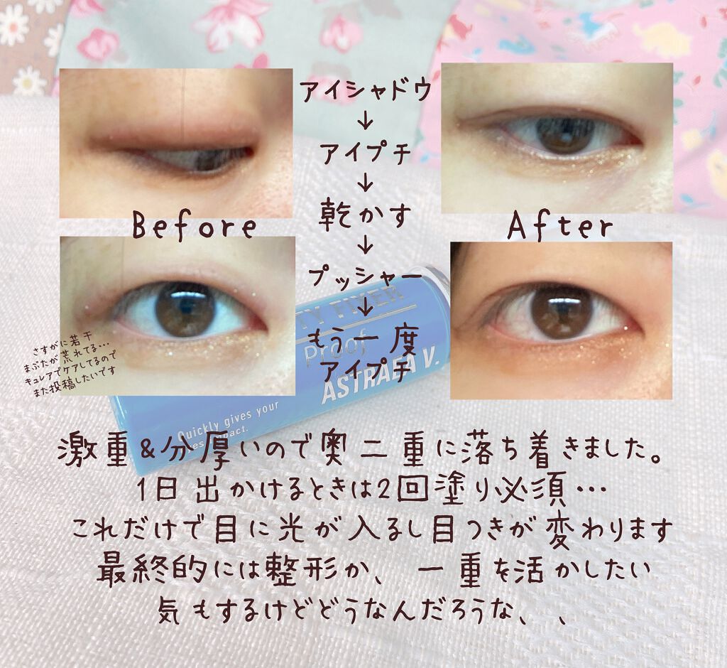 アイビューティー フィクサー WP/アストレア ヴィルゴ/二重まぶた用アイテムを使ったクチコミ(3枚目)