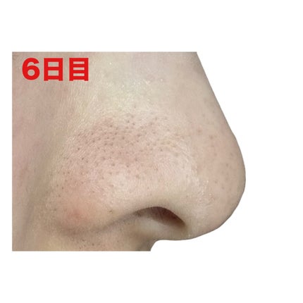 ディープクリア酵素洗顔 /メラノCC/洗顔フォームを使ったクチコミ(9枚目)