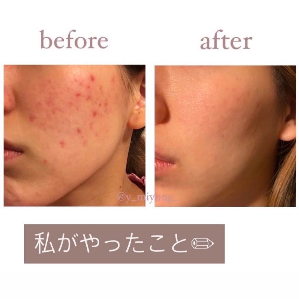 アルガンオイル/エトヴォス/フェイスオイルを使ったクチコミ(1枚目)