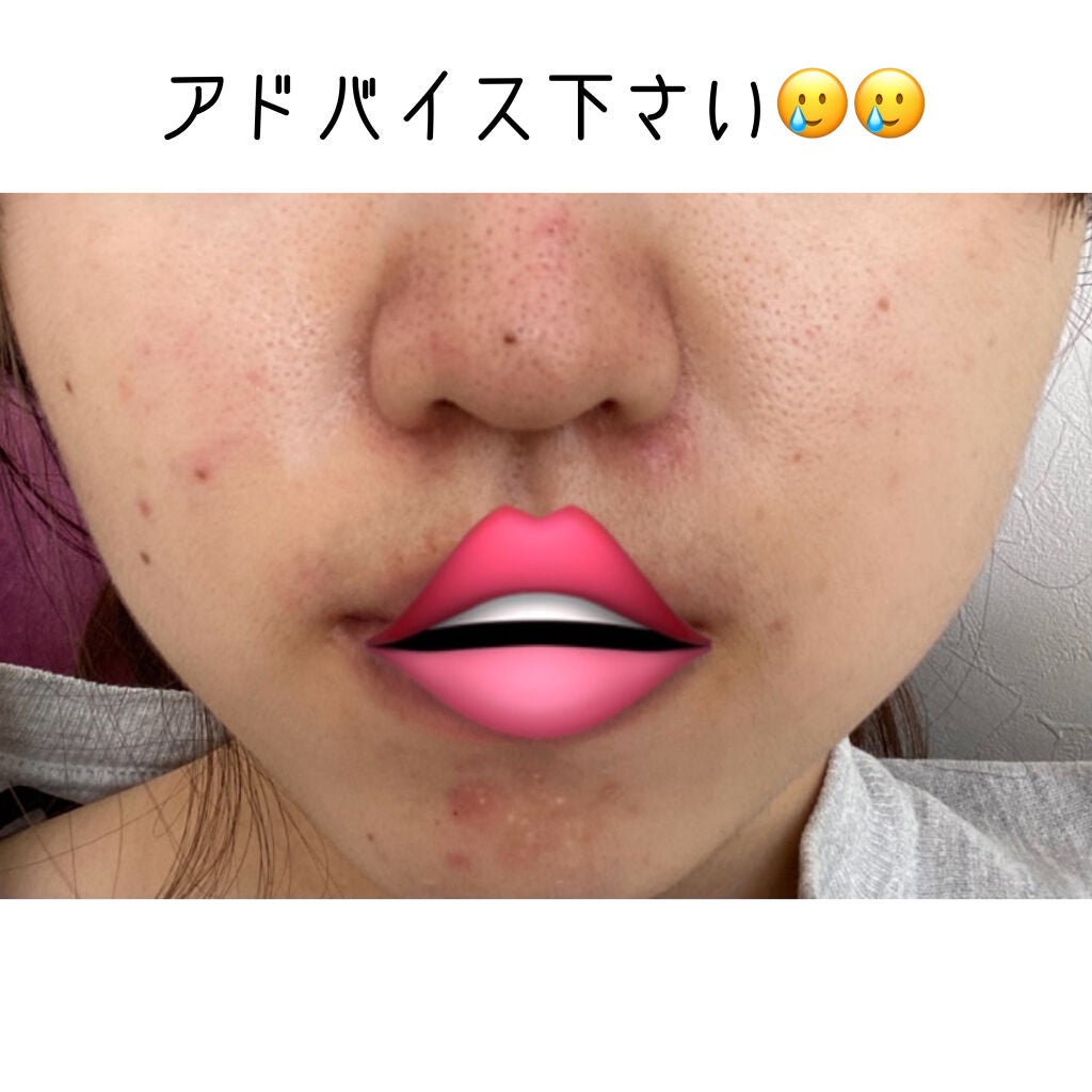 ハトムギ化粧水(ナチュリエ スキンコンディショナー R )/ナチュリエ/化粧水を使ったクチコミ(1枚目)