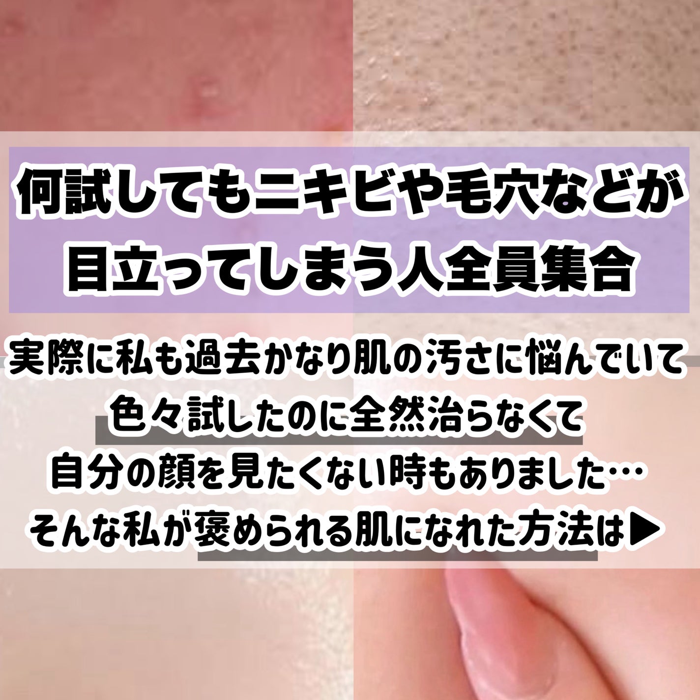 ふきとり化粧水/ちふれ/拭き取り化粧水を使ったクチコミ(2枚目)