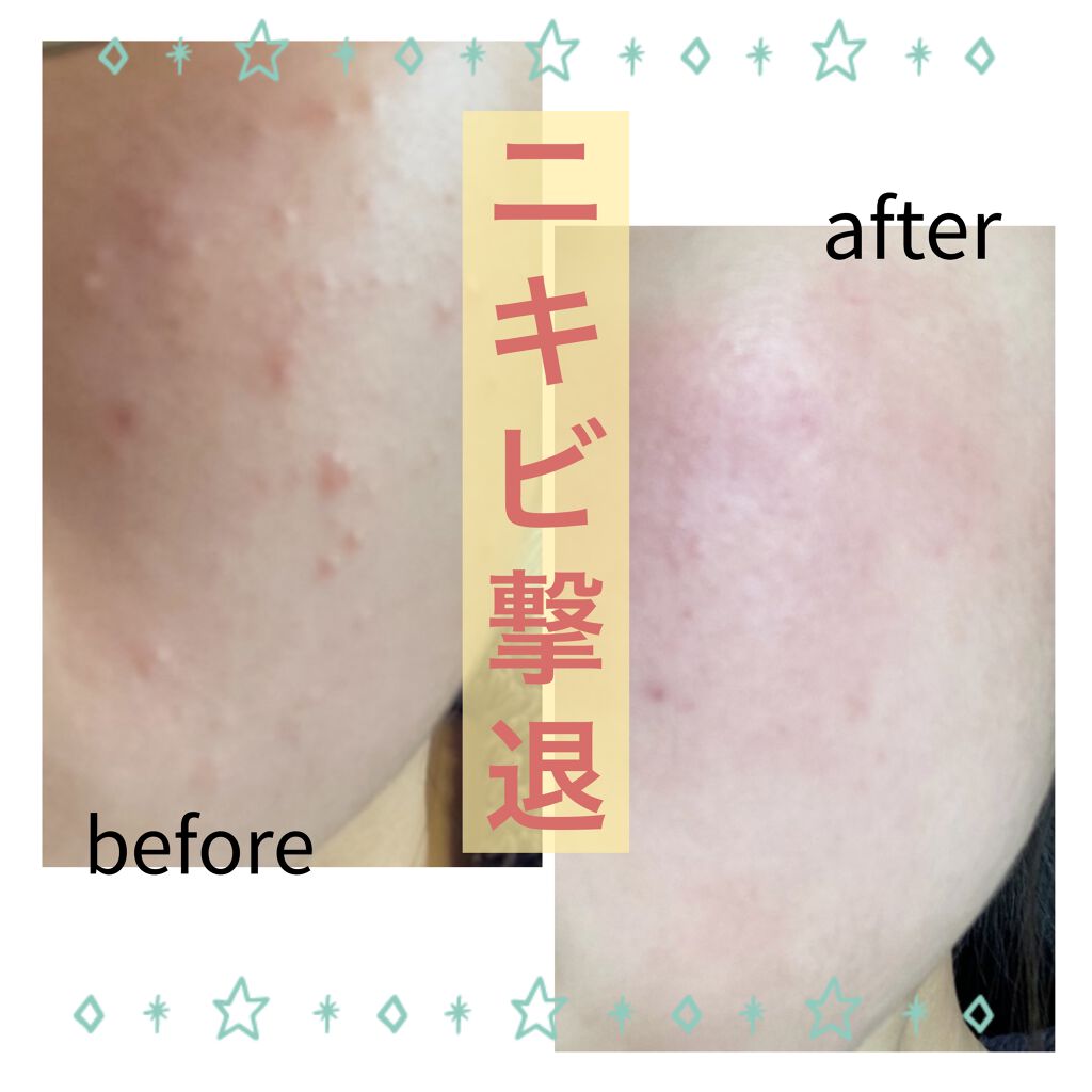 スキンケアセット（とてもしっとり）/IHADA/トライアルキットを使ったクチコミ（1枚目）