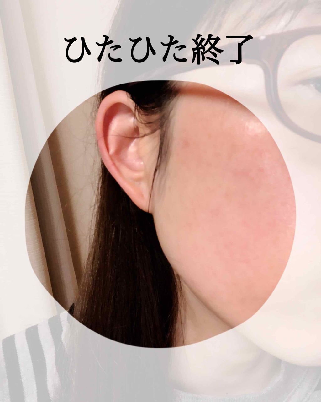 お米のマスク/毛穴撫子/シートマスク・パックを使ったクチコミ（3枚目）