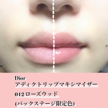 【旧】ディオール アディクト リップ マキシマイザー/Dior/リップグロスを使ったクチコミ（2枚目）