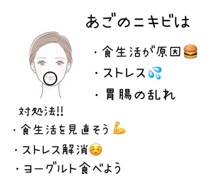 Chitose♪ on LIPS 「ニキビ位置で原因がわかる!!みなさんはニキビの位置で原因がわか..」(5枚目)