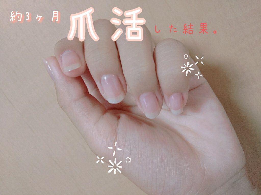 つめやすり/DAISO/ネイル用品を使ったクチコミ（1枚目）