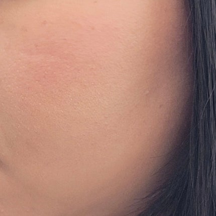 チーク ポップ/CLINIQUE/パウダーチークを使ったクチコミ(3枚目)