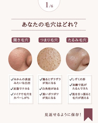 ビオレ おうちdeエステ 肌をなめらかにする マッサージ洗顔ジェルのクチコミ「@yun.skincare_←化粧品研究者が教えるスキンケア

＊＊＊＊＊＊＊＊＊＊＊＊＊＊＊.....」（2枚目）