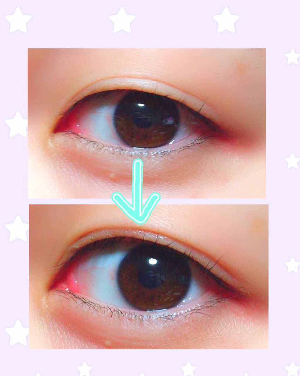 ガールズメーカー エタニティラインα/Girl's Maker/二重まぶた用アイテムを使ったクチコミ（2枚目）