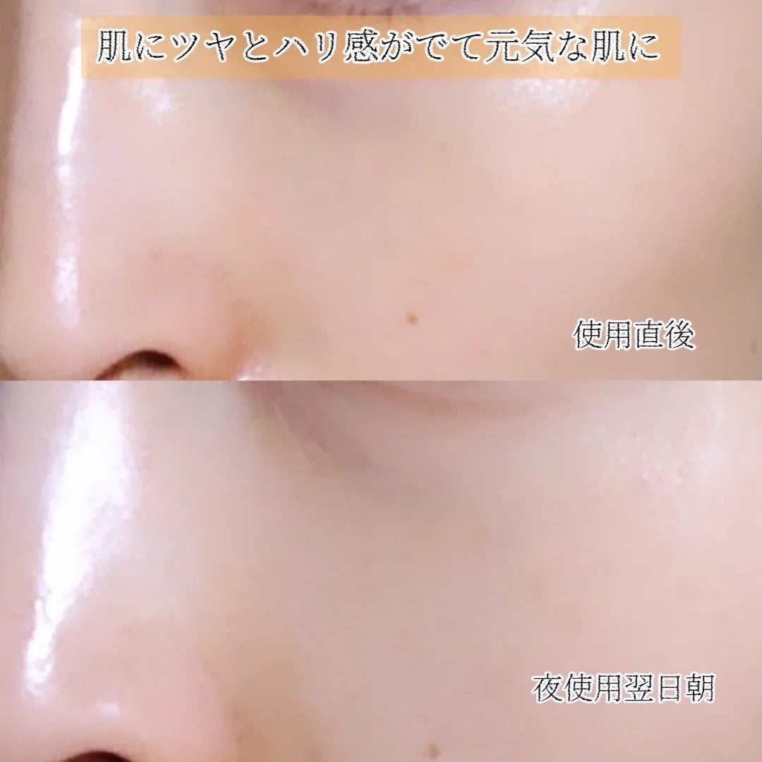 滋陰生(ジャウムセン)アンプル / ブライトニングアンプル/Sulwhasoo/美容液を使ったクチコミ(6枚目)