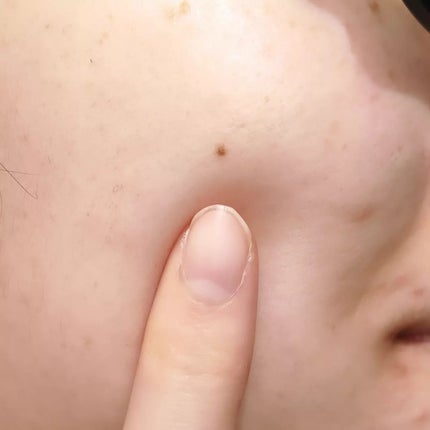 クリアエッセンス エッセンシャルトナー/ピュレア/化粧水を使ったクチコミ(4枚目)