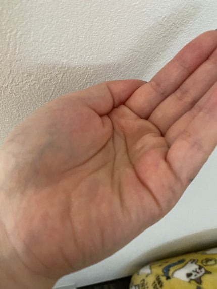 クラリフィック デュアル エッセンス ローション/LANCOME/化粧水を使ったクチコミ(3枚目)