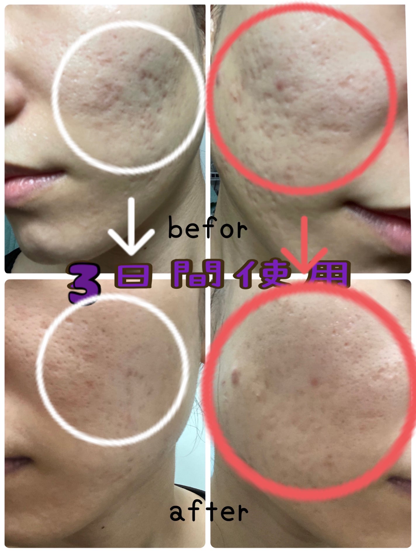 AGE-R ブースタープロ|MEDICUBEの効果に関する口コミ - 【使っ AGE-R ブースタープロ|MEDICUBEの効果に関する口コミ - 【使っ