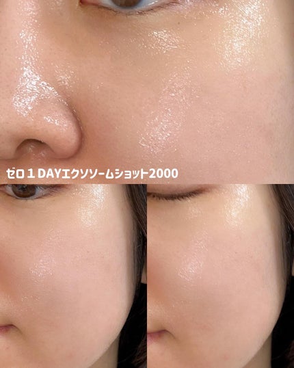 ゼロ1DAYエクソソームショット2000/MEDICUBE/美容液を使ったクチコミ(3枚目)
