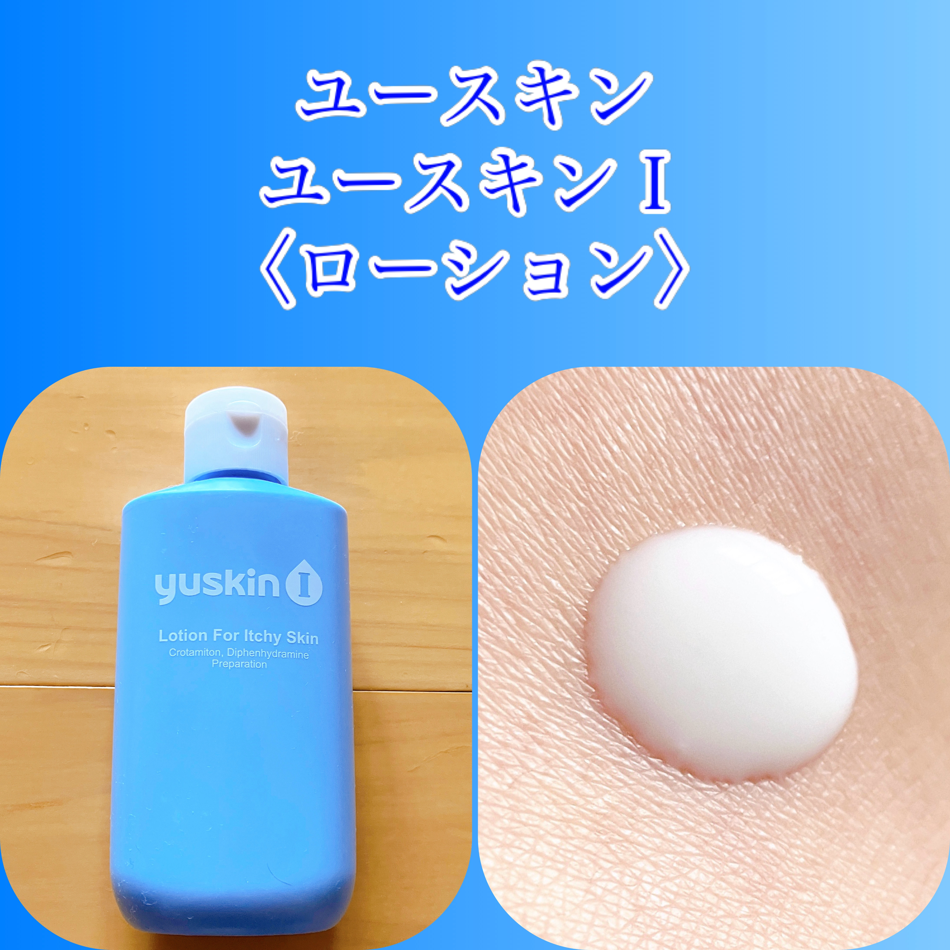 ユースキンIローション（医薬品）/ユースキンI(アイ)/その他を使ったクチコミ（1枚目）