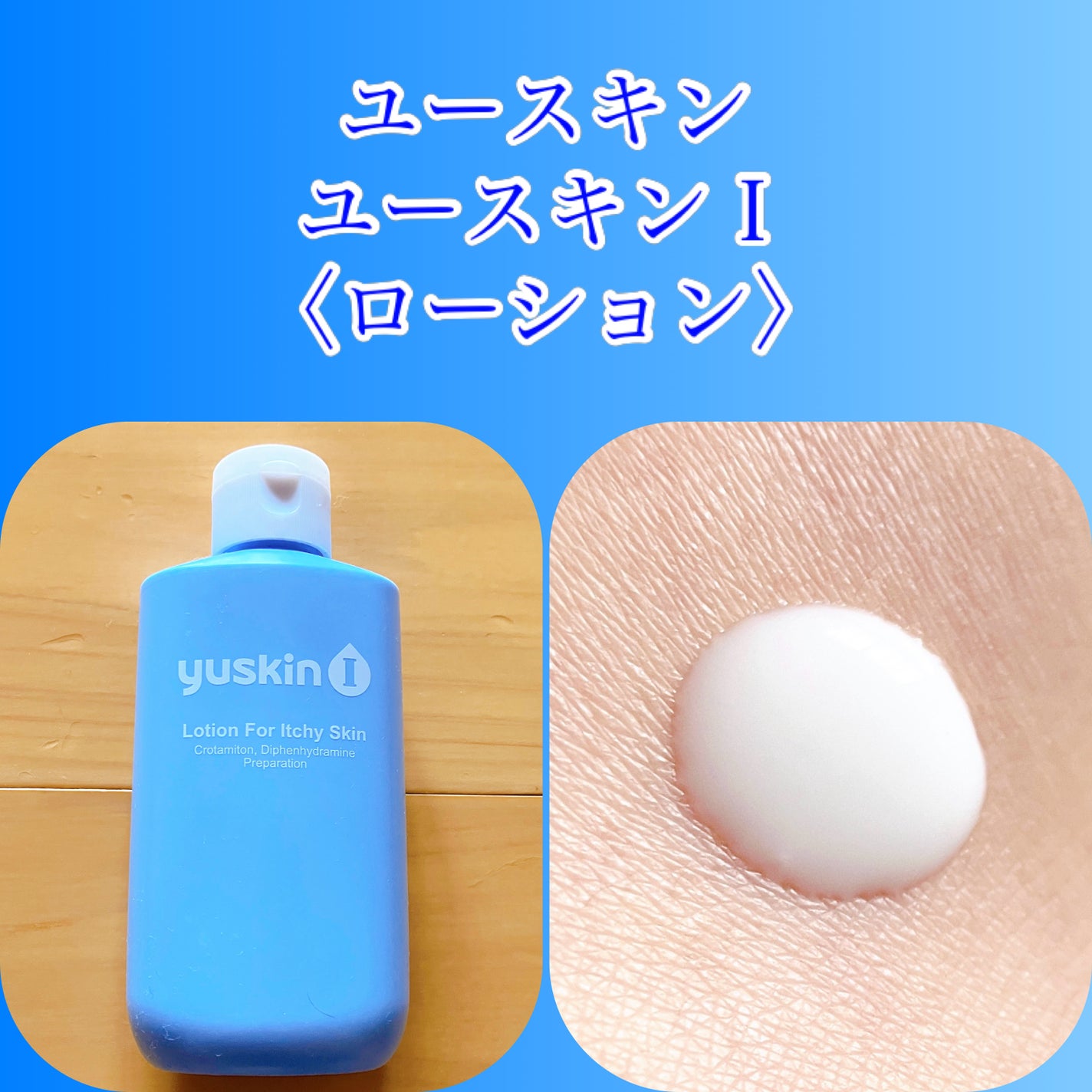 ユースキンIローション(医薬品)/ユースキンI(アイ)/その他を使ったクチコミ(1枚目)