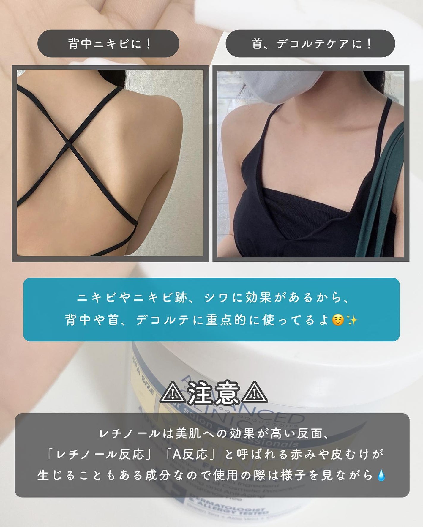 レチノールアドバンスドファーミングクリーム/ADVANCED CLINICALS/ボディクリームを使ったクチコミ(4枚目)