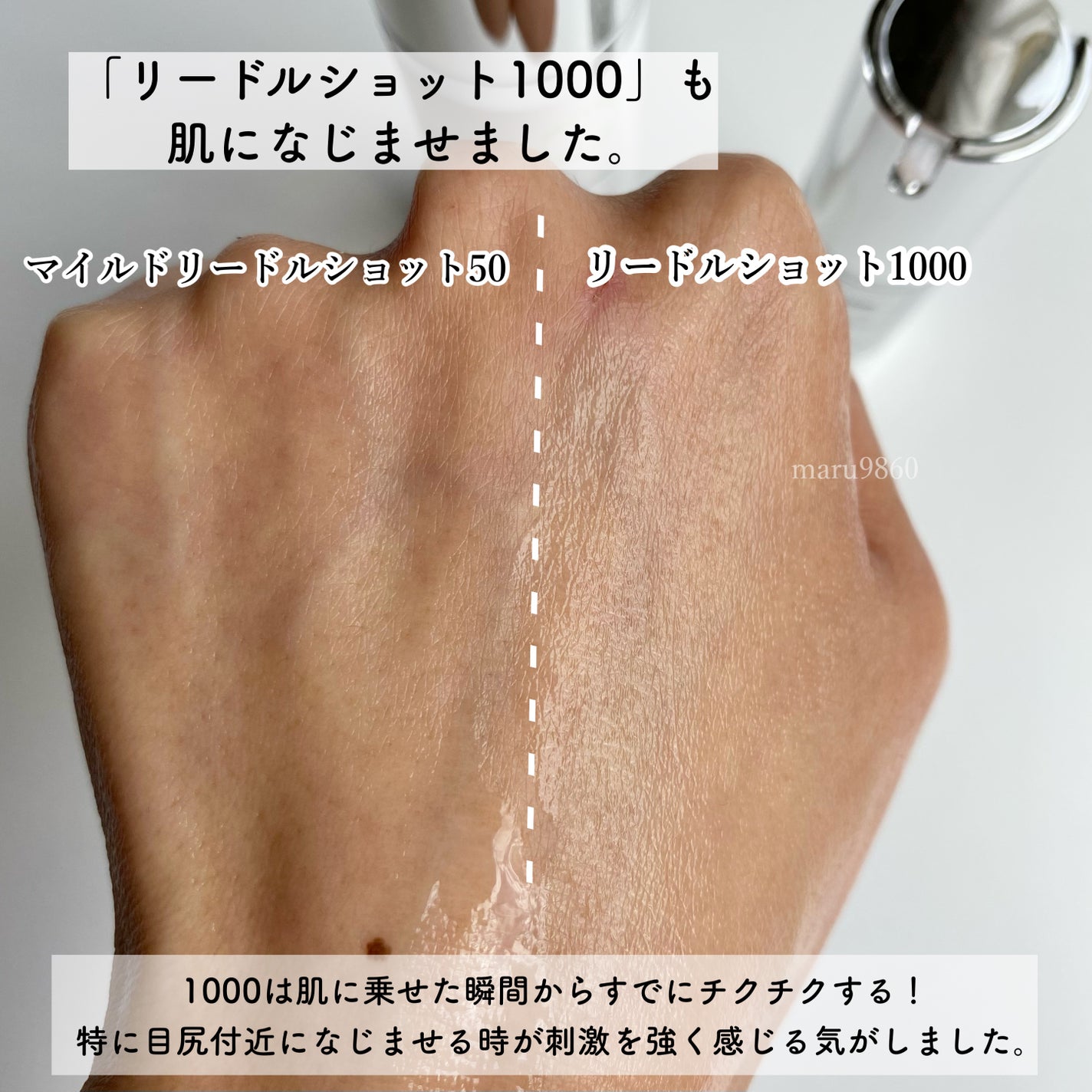 マイルドリードルショット50/VT/美容液を使ったクチコミ(5枚目)