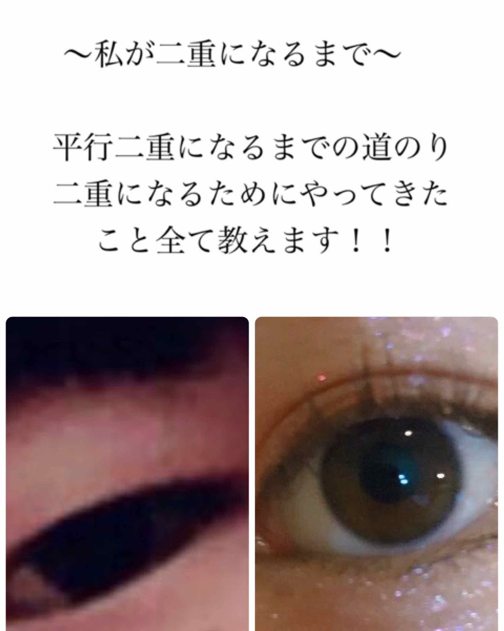 ガールズメーカー エタニティラインα/Girl's Maker/二重まぶた用アイテムを使ったクチコミ（1枚目）