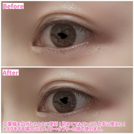 ダブリー/ルドゥーブル/二重まぶた用アイテムを使ったクチコミ(5枚目)