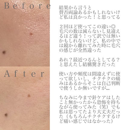 リードルショット300/VT/美容液を使ったクチコミ(2枚目)