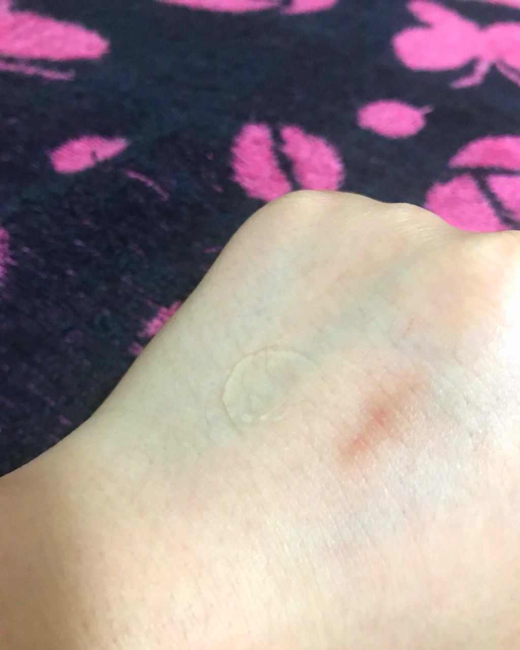 金のプラセンタもっちり白肌濃シワトール/ホワイトラベル/アイケア・アイクリームを使ったクチコミ（3枚目）