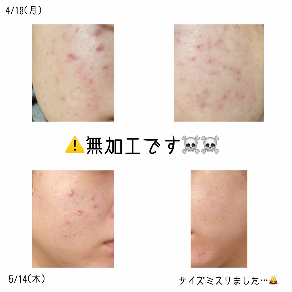 明色美顔水 薬用化粧水/美顔/化粧水を使ったクチコミ（3枚目）