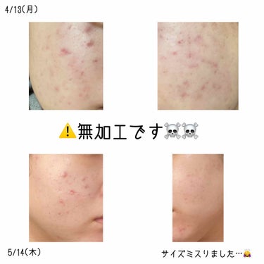 明色 美顔水 薬用化粧水/美顔/化粧水を使ったクチコミ（3枚目）