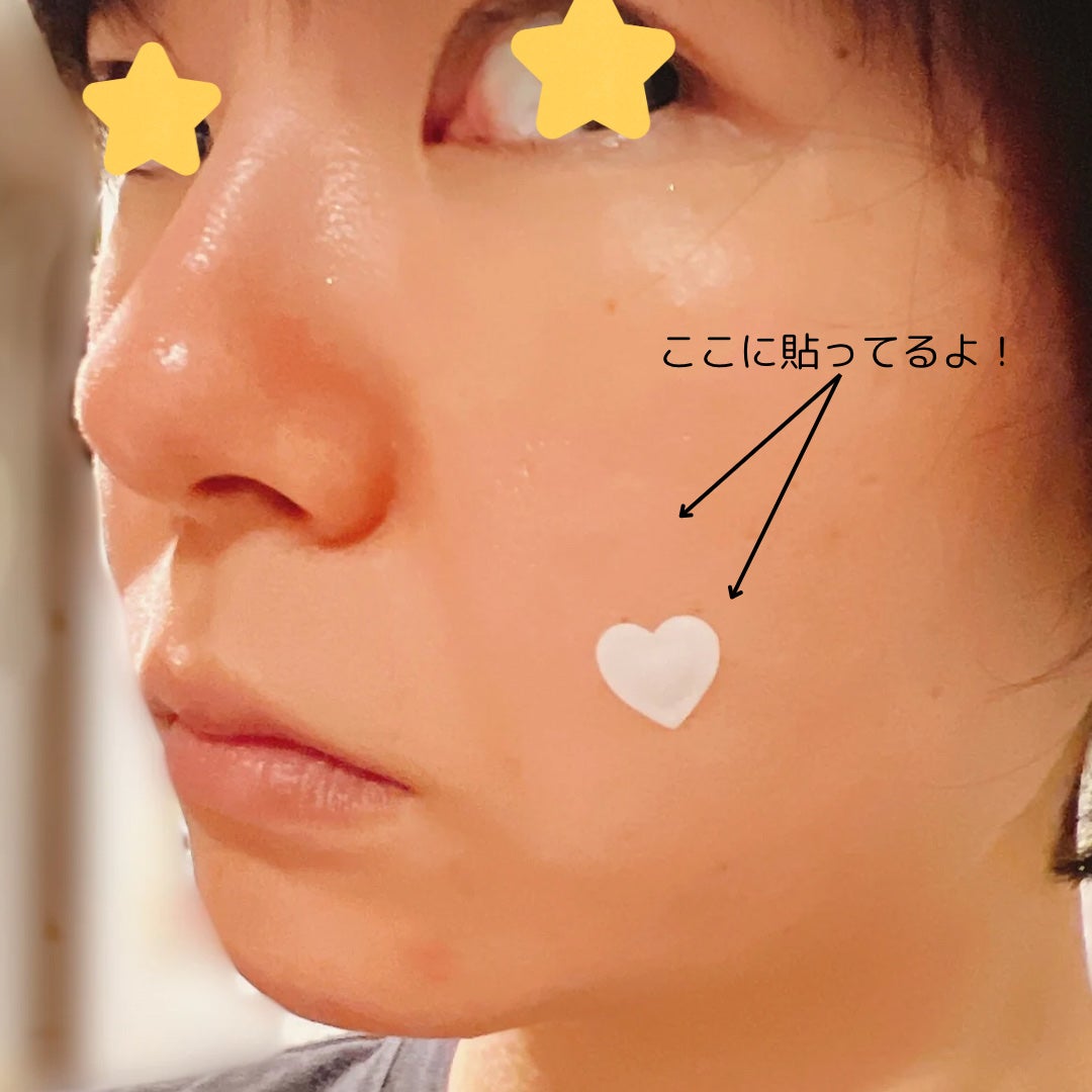 プロCICA クリアスポットパッチ/VT/その他スキンケアを使ったクチコミ(6枚目)