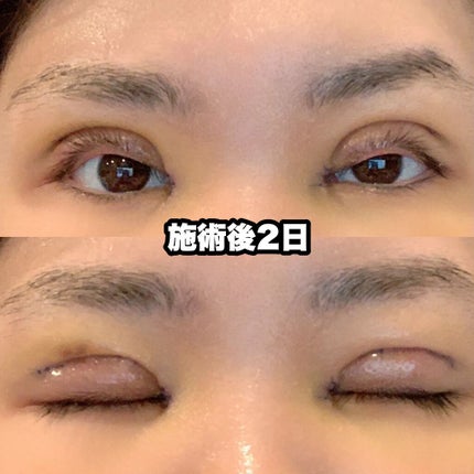 ïŸïœïœ³âžð·ïžâžâ on LIPS ãããã«ã¡ã¯ïŸïœïœ³ã§ãâžð·ïžâžâå
æ¥äºéæŽåœ¢ãããŸããïŒä»åã¯ç§..ãïŒ4æç®ïŒ